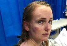 Mujer sufre graves lesiones por proteger a su bebé de granizo