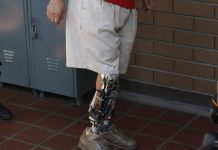 UNAM crea licenciatura para desarrollo y fabricación de prótesis