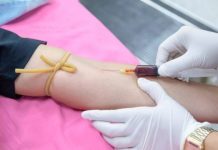 Paciente en Londres se convierte en el segundo caso de cura funcional de VIH