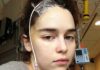 Emilia Clarke y sus fotos cuando estuvo a punto de morir