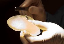 COEPRISS alerta sobre el riesgo para la salud de implantes mamarios y expansores de tejido de la empresa Allergan