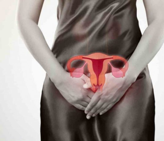 Síntomas de cáncer de ovario que las mujeres pueden ignorar