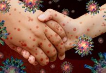 ¿Es peligrosa? ‘Enfermedad X’, la posible amenaza que tiene en alerta a la OMS