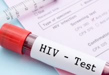 Tener VIH, no informarlo e infectar podría llevar a una persona a la cárcel en CdMx