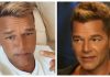 Ricky Martin: Revelan la preocupante razón del radical cambio en su rostro