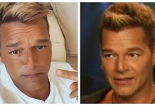 Ricky Martin: Revelan la preocupante razón del radical cambio en su rostro