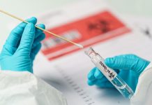 Pruebas de antígenos para detectar covid-19 son más precisas de lo pensado: expertos